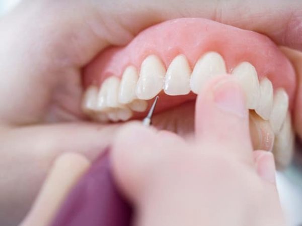 عيادة تعزيز الأسنان في ماكاتوEnhance Dental in Makati