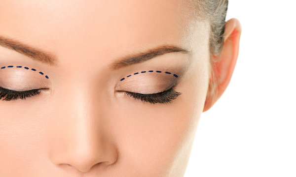 تجربتي مع عمليات التجميل في كوريا بالتفصيل